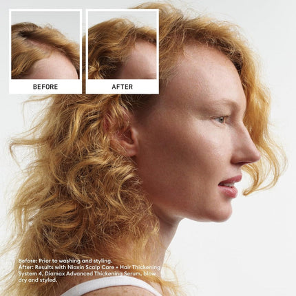 Nioxin System 4 Leave In Treatment - Color Treated With Progressed Thinning