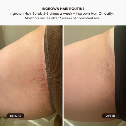 Bushbalm Ingrown Hair Exfoliating Scrub - Watermelon Sugar