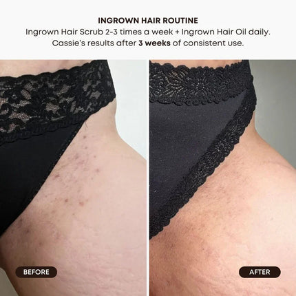 Bushbalm Ingrown Hair Oil - Watermelon Sugar