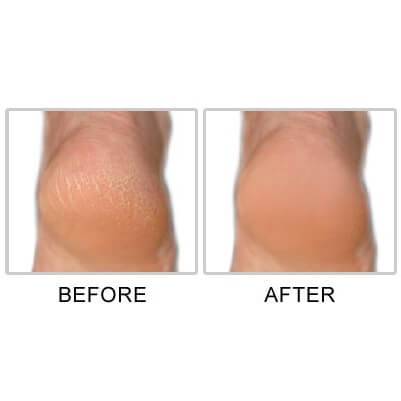 Mr. Pumice Callus Terminator - HB Beauty Bar