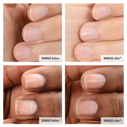 ZOYA Rescue & Repair Save My Nails Kit