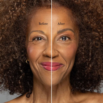 billion-dollar-brows-billion-dollar-brow-lift-4