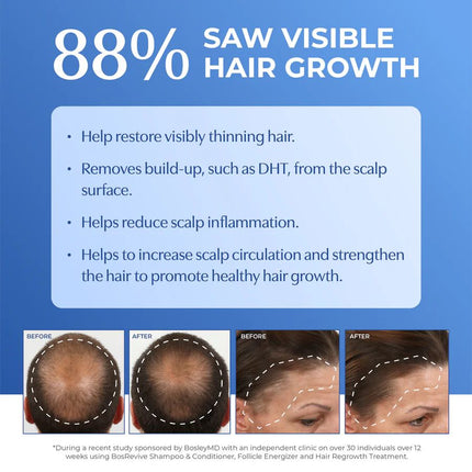 bosleymd-bosrevive-non-color-treated-hair-thickening-treatment-3