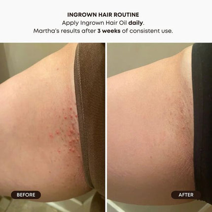 Bushbalm Ingrown Hair + Pre-Post Wax Oil - Frosted Cranberry