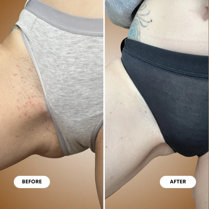 Bushbalm Vanilla Coconut Ingrown Hair Exfoliating Scrub