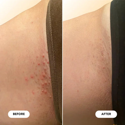 Bushbalm Ingrown Hair Oil - Vanilla Tangerine
