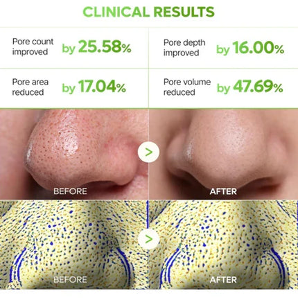 Dr. Melaxin CACTOX 3-Step Nose Mask Pack