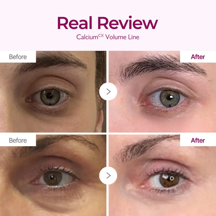 Dr. Melaxin Calcium Intense Cream