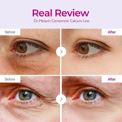 Dr. Melaxin Calcium Volume Eye Patch - 60 Each