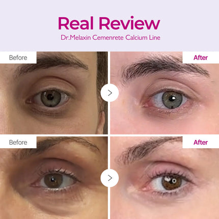 Dr. Melaxin Cemenrete Calcium Intense Ampoule