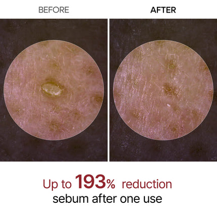 Dr. Melaxin Peel Shot Glow Black Rice Ampoule