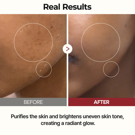 Dr. Melaxin Peel Shot Glow Rice Toner