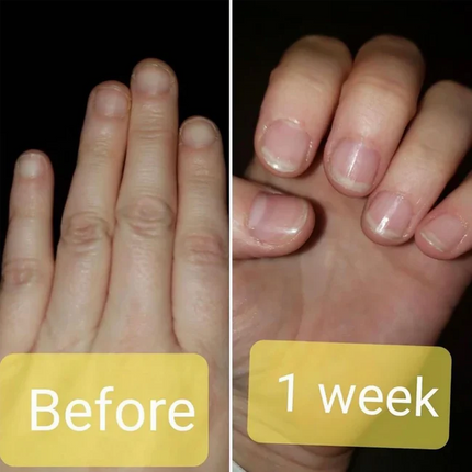 ella+mila Damage Control (Horsetail Plant Nail Strengthener)