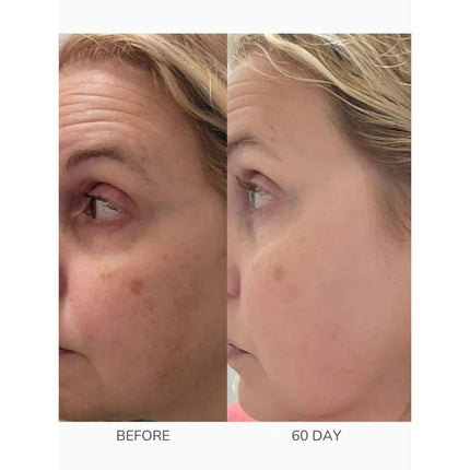 emani-cosmetics-age-less-super-serum-kit-2