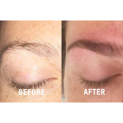 NourishBrow Eyebrow Growth Serum