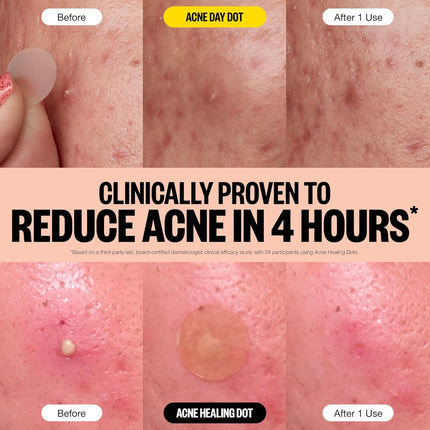 Peace Out Acne Day & Night Duo
