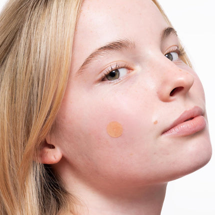 Peace Out Acne Healing Dots Jumbo