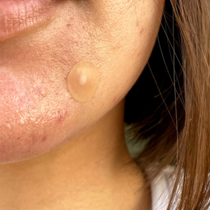 Peace Out Acne Healing Dots Jumbo