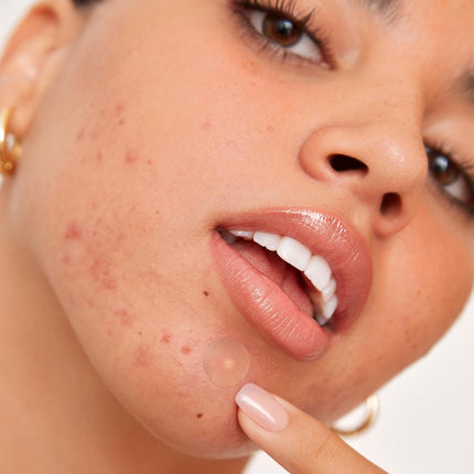 Peace Out Acne Healing Dots Jumbo
