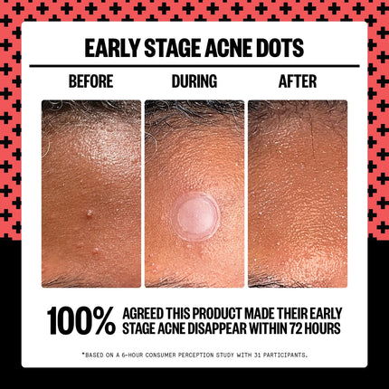 Peace Out Early Stage Acne Dots