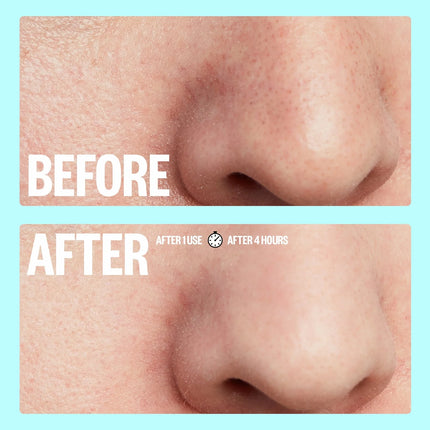 Peace Out Pore Minimizing Strips