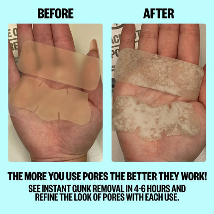 Peace Out Pore Minimizing Strips