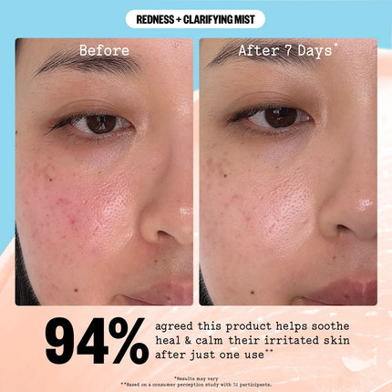 Peace Out Redness + Clarifying Mist