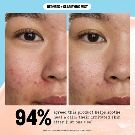 Peace Out Redness + Clarifying Mist