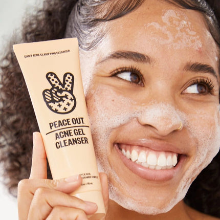 peace-out-skincare-acne-gel-cleanser-2