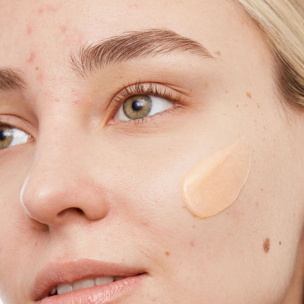 peace-out-skincare-acne-gel-cleanser-5