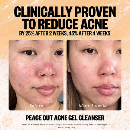 peace-out-skincare-acne-gel-cleanser-6