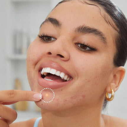 peace-out-skincare-acne-healing-dots-10