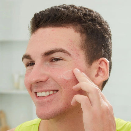 peace-out-skincare-acne-serum-9