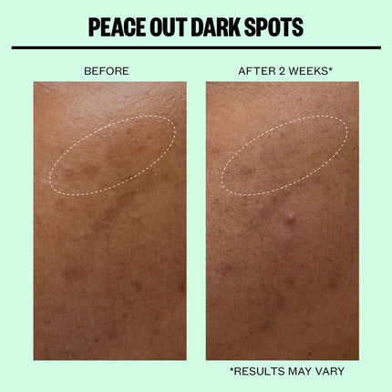 peace-out-skincare-dark-spots-microneedling-dots-5