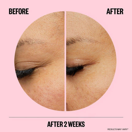 peace-out-skincare-peace-out-wrinkles-3