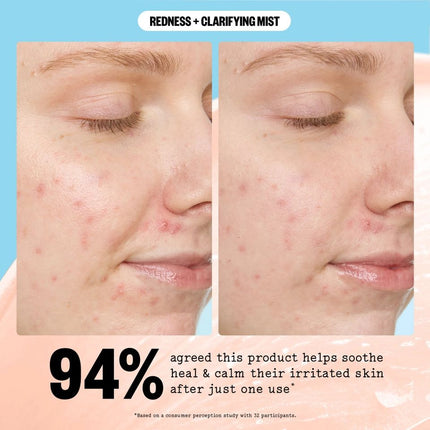 peace-out-skincare-redness-clarifying-mist-11