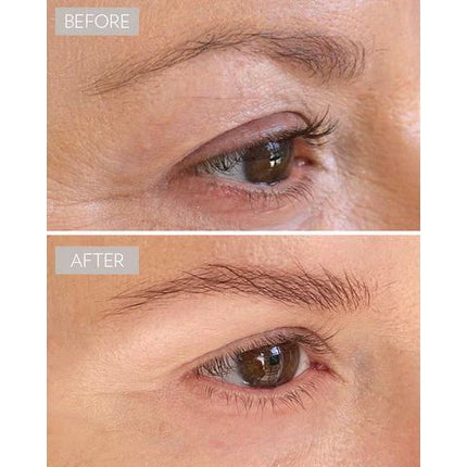 sarah-maxwell-beauty-the-brow-mask-hydrogel-mask-4
