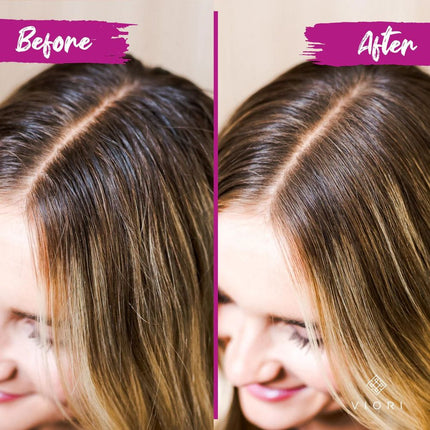 viori-beauty-magnolia-peony-dry-shampoo-3